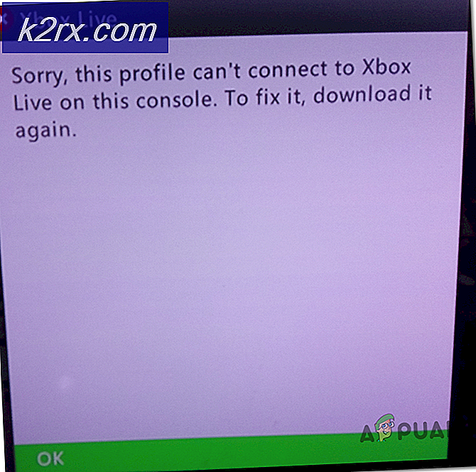 Hur löser jag ”Den här profilen går inte att ansluta till Xbox Live på den här konsolen” -felet?