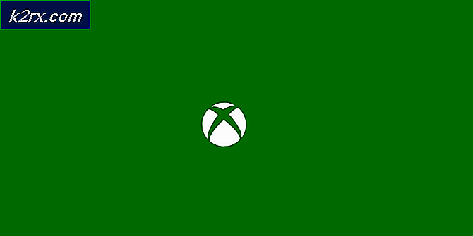 So entfernen Sie die Xbox App in Windows 10
