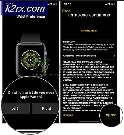 need, will, twear, sure, ysmartwatch, ospp, setprocess, follow, başarılı, smartwatch, ysmartwatchnd, yphone, enable, smartwatchnd, putn